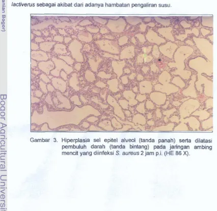 Gambar 3. Hiperplasia sel epitel a l v d  (tanda panah) serta dilatasi 
