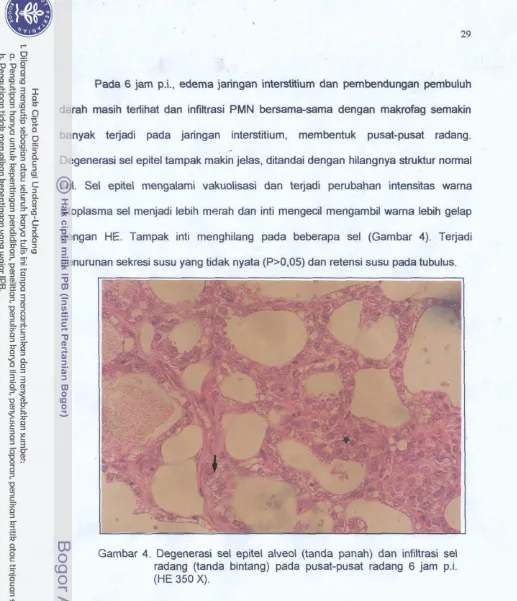 Gambar 4. Oegenerasi sel epitel alveol (tanda panah) dan infinrasi set 