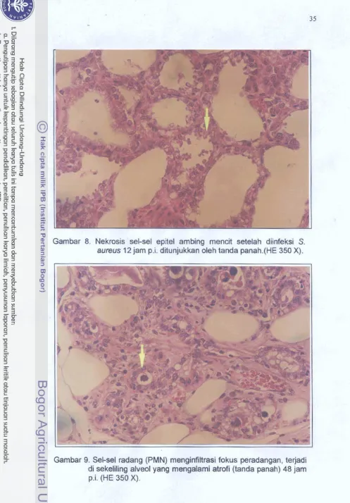 Gambar 9. Sel-sel radang (PMN) menginfiltrasi fokus peradangan, terjadi 