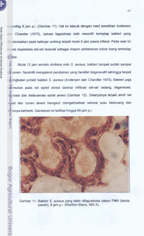 Gambar 11. Bakteti S. aureus yang tdah diigositosis dalam PMN (tanda 