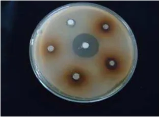 Tabel 5. Hasil uji aktivitas antibakteri sediaan krim ekstrak patikan kebo dengan basis tipe  M/A 