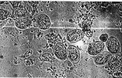 Gambar 9. Morfologi telur cacing Stongyloides sp dengan pembesaran 100x 