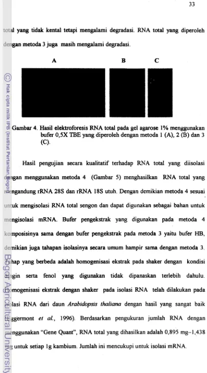Gambar 4. Hasil elektroforesis RNA total pada gel agarose 1% menggunakan 