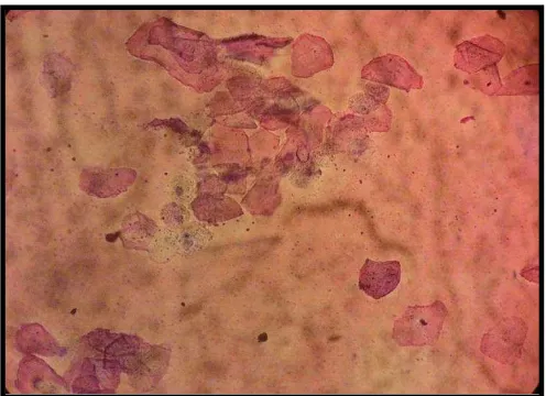 Gambar 5. Foto Mikroskopis Epitel Vagina Tikus Putih Fase Estrus Perbesaran 100x (Foto Hasil Dokumentasi Penelitian, 2015) 