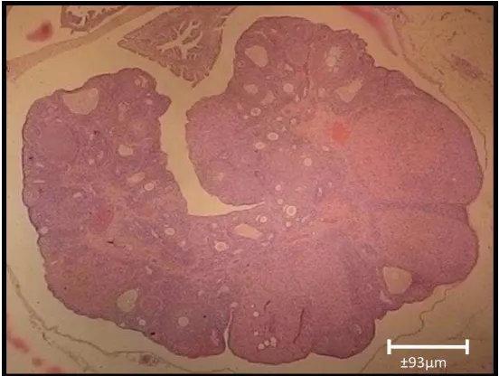 Gambar 6. Foto Mikroskopis Ovarium Tikus Putih Perlakuan Pemberian  Ekstrak Kacang Merah (HE, perbesaran 10x) 
