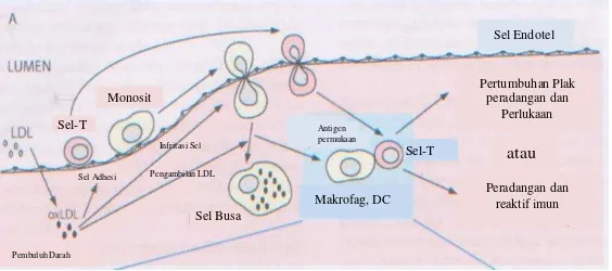 Gambar 9 Keberadaan  sel antigen pada plak aterosklerosis dan sel T pada permukaan endotel menandakan dimulainya kejadian imunologik