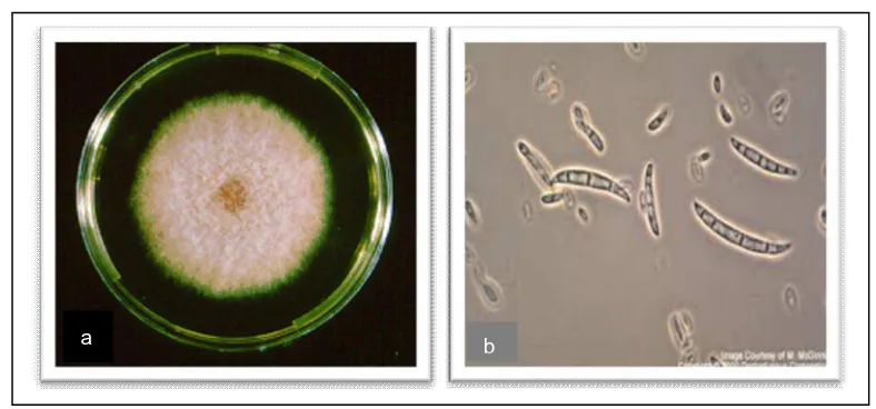 Gambar 2. (a) Jamur Fusarium oxysporum pada Media PDA (b) Konidia Jamur Fusarium oxysporum