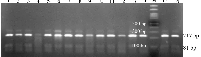 Gambar 7. Visualisai PCR-RFLP ruas gen GHR|AluI pada gel agarosa 2%.M: Marker 100 bp, 1-16: Sampel kerbau penelitian.