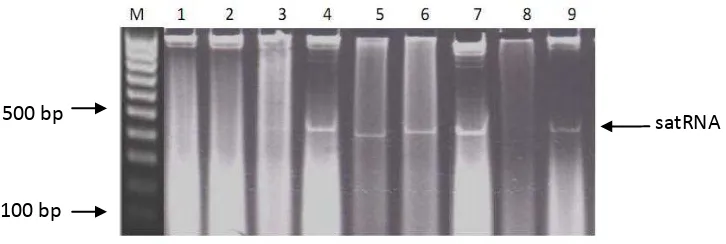 Figure 1. Profile of satRNA in mild strains of Cucumber mosaic virus (CMV) obtained from 