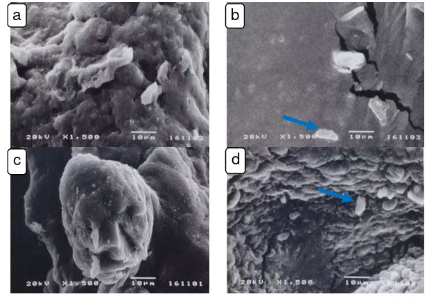 Gambar 11 Hasil scanning electron microscope (SEM) bakteri probiotik              L. acidophilus (La RRM-01) dan B