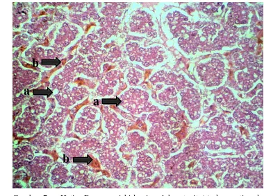 Gambar 7    Hati : Degenerasi hidropis sel hepatosit (a), kongesti pada sinusoid hati (b) pada kelompok P2, (pewarnaan HE, pembesaran objektif  40 kali)