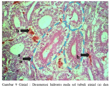 Gambar 9 Ginjal : Degenerasi hidropis pada sel tubuli ginjal (a) dan 
