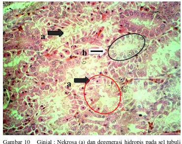 Gambar 10    Ginjal : Nekrosa (a) dan degenerasi hidropis pada sel tubuli 