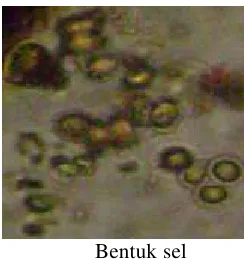 Gambar 1 Bentuk dan ukuran sel Chlorella sp. 
