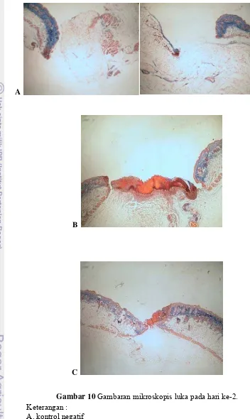 Gambar 10 Gambaran mikroskopis luka pada hari ke-2. 