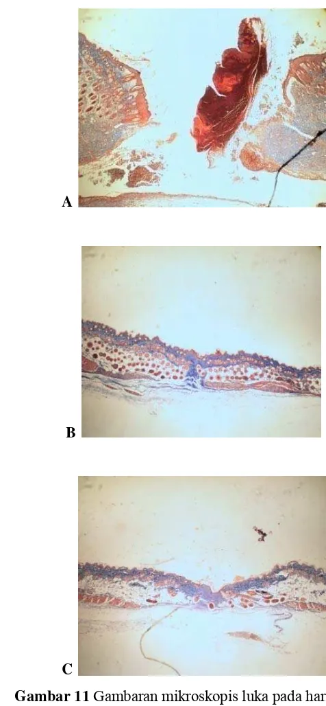 Gambar 11 Gambaran mikroskopis luka pada hari ke-21. 