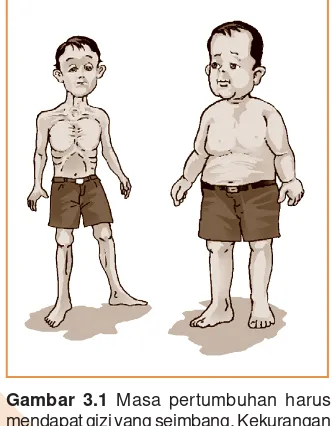 Gambar 3.1 Masa pertumbuhan harus mendapat gizi yang seimbang. Kekurangan gizi menyebabkan tubuh kurus (kiri)