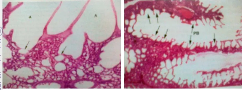 Gambar 2 Histologi paru-paru ayam normal berupa alveolus (A), parabronchus (PB), 