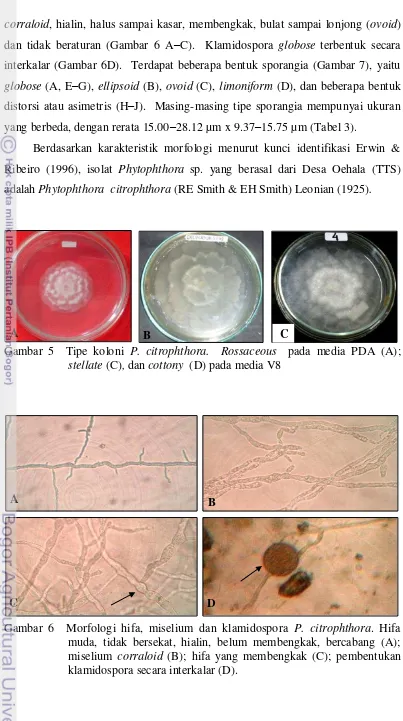 Gambar 6  Morfologi hifa, miselium dan klamidospora P. citrophthora. Hifa muda, tidak bersekat, hialin, belum membengkak, bercabang (A); miselium corraloid (B); hifa yang membengkak (C); pembentukan klamidospora secara interkalar (D)