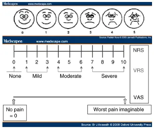 Gambar 6. VAS (Medscape 2008) 