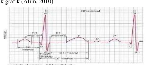 Gambar 2.1 R-R interval pada Electrocardiogram (EKG) (Alim, 2010)     