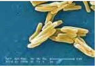 Gambar 3.4 : Mycobacterium tuberculosa