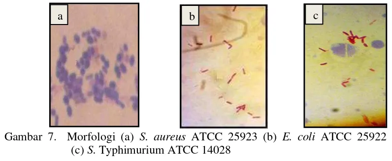 Gambar 6.  Morfologi (a) B. longum Y-01 dan (b) L.acidophilus Y-01 