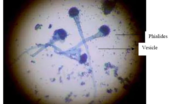 Gambar 2. Bacillus pasteurii dengan perbesaran 1000x 