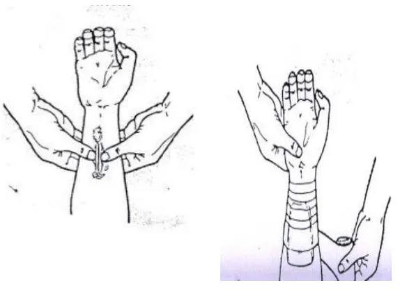 Gambar 2, Tangan Terluka  