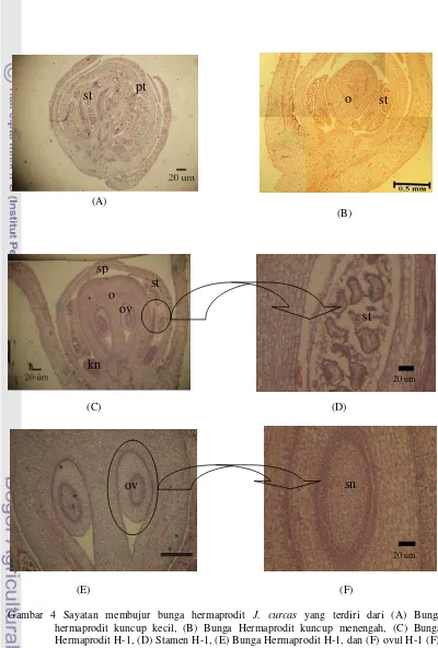 Gambar 4 Sayatan membujur bunga hermaprodit J. curcas yang terdiri dari (A) Bunga 