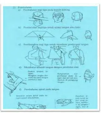 Gambar 10. Cara Pembalutan pada Cedera.