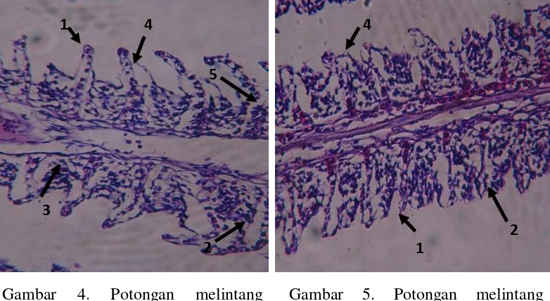 Gambar 5. Potongan melintang struktur mikroanatomi insang ikan Nila Larasati pada konsentrasi 259,51 ppm (AII) (perbesaran 10x40) 