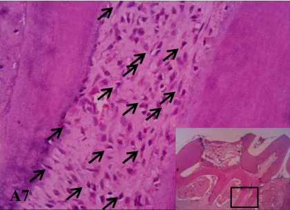 Gambar 4. Gambaran mikroskopik pulpa A1terbuka kelompok hari ke-1 dengan jumlah fibroblas sebanyak 7 terlihat pada area dekat jejas 