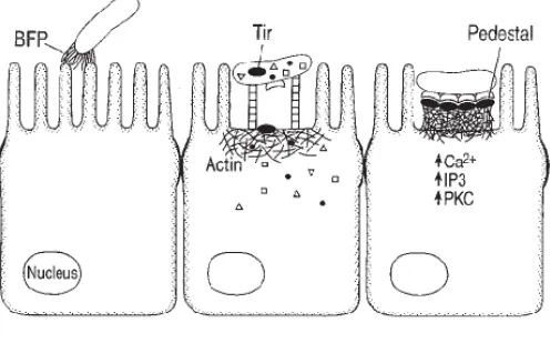 Gambar 3. Infeksi EPEC pada epitel usus inang 