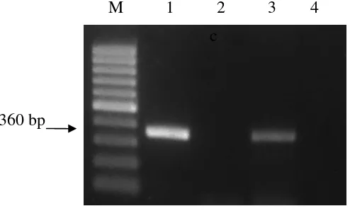 Gambar 6  Hasil amplifikasi DNA genom virus dengan metode RT-PCR menggunakan pasangan primer spesifik ToCV-CF dan ToCV-CR terhadap sampel daun tanaman tomat yang positif terinfeksi tunggal oleh ToCV (lajur 1), positif terinfeksi tunggal oleh TICV (lajur 2)