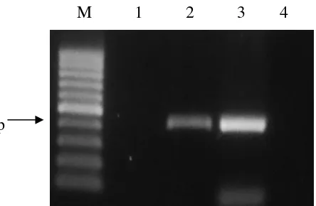 Gambar 7  Hasil amplifikasi DNA genom virus dengan metode RT-PCR menggunakan pasangan primer spesifik TICV-CF dan TICV-CR terhadap sampel daun tanaman tomat yang positif terinfeksi tunggal oleh ToCV (lajur 1), positif terinfeksi tunggal oleh TICV (lajur 2)