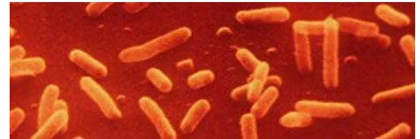 Gambar 2  Salmonella typhimurium (Bio Research Laboratories, Inc. 2010). 