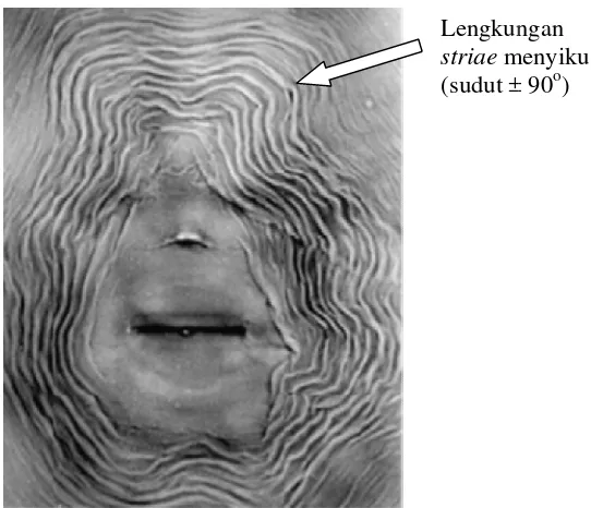 Gambar 3 Ciri khusus pola p          2003)pola perineal Meloidogyne incognita (Sumber : Eisenba(Sumber : Eisenback