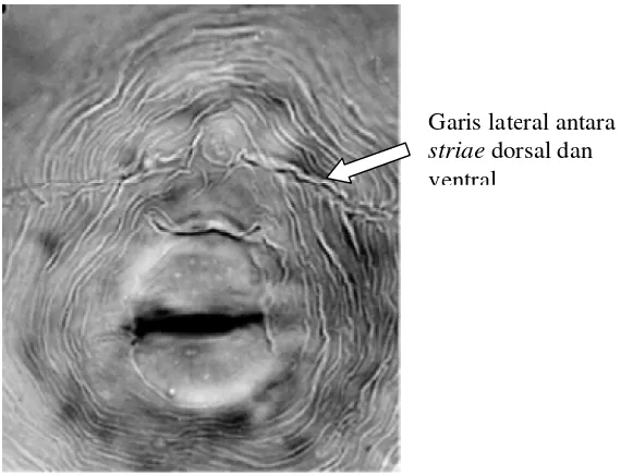 Gambar 5 Ciri khusus p          2003)pola perineal Meloidogyne javanica (Sumber: EisenbacEisenback