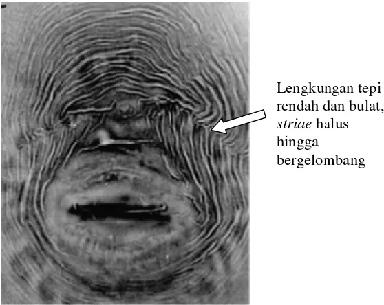 Gambar 6 Ciri khusus p          2003)Ciri khusus pola perineal Meloidogyne arenaria (Sumber: EisenbacEisenback