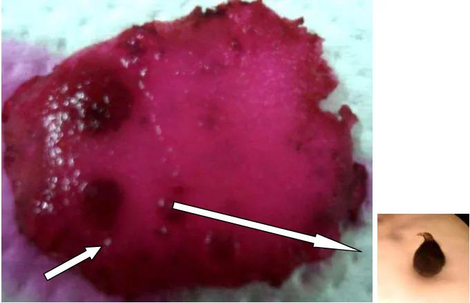 Gambar 10  Gejala nekrosis akibat infeksi dan NPA betina pada umbi kentang                     asal Pangalengan hasil pengamatan di bawah mikroskop 