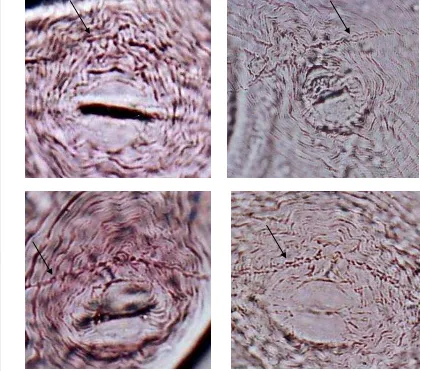 Gambar 11  Garis lateral dari contoh pola perineal Meloidogyne javanica hasil                     identifikasi pada umbi kentang asal Pangalengan 