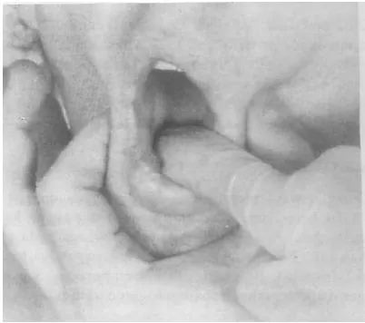 Gambar 6. Teknik Palpasi Struktur Dasar Mulut 