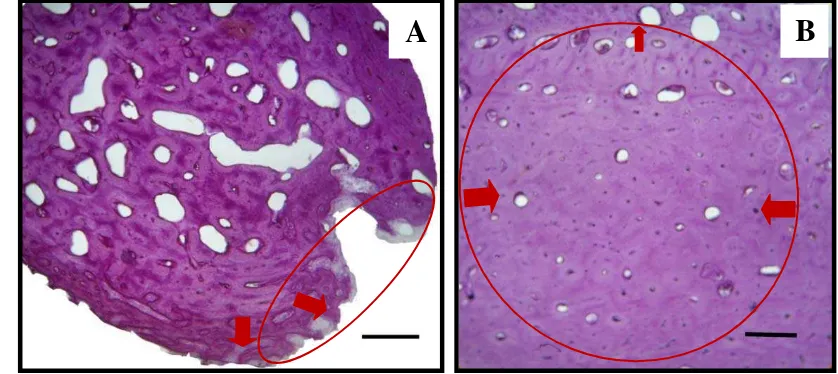Gambar 9  Gambaran mikroskopis persembuhan tulang kontrol pada hari ke-60 pascaoperasi, terbentuk tulang kompakta dengan struktur osteon (lingkaran merah), saluran Haver’s (H), saluran Volkmann (V), dan osteosit (OS)