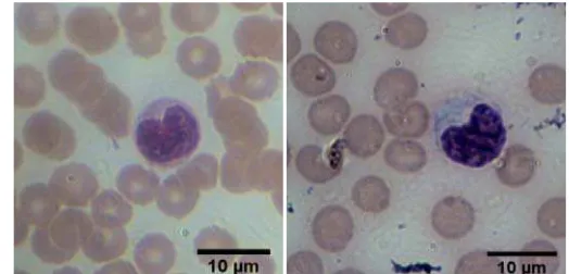 Gambar 26 morfologi sel mieloblas; A. morfologi setelah perlakuan; B. morfologi setelah   