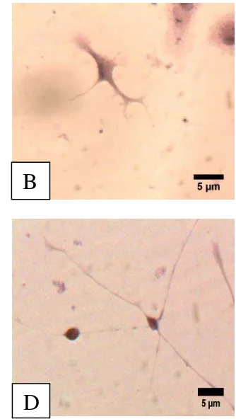 Gambar 5 Sel glia astrosit (A), oligodendrosit (B), mikroglia (C), dan sel saraf 