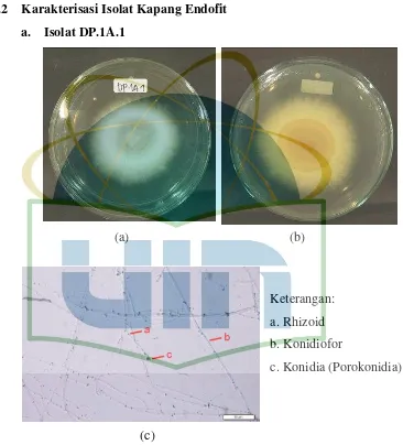 Gambar 4.2. Isolat DP.1A.1 Kapang Endofit Daun Crinum asiaticum L 