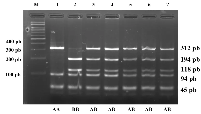 Gambar 5.  Hasil Pemotongan Fragmen Gen GHRH Menggunakan Metode PCR-RFLP dengan Enzim Pemotong HaeIII pada Gel Agarosa 2% 