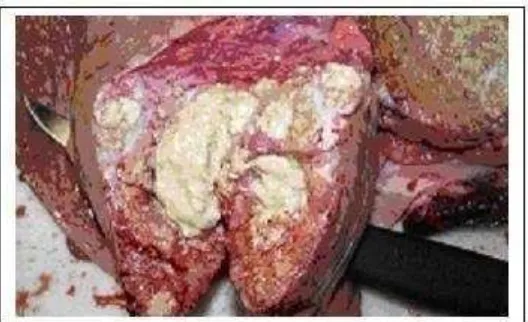 Gambar 2.2. Lesi tuberkulosis pada paru sapi dara umur 2 tahun. Sumber : 