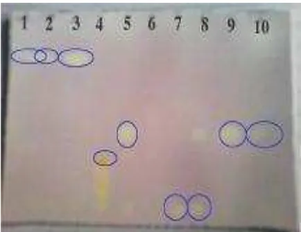 Gambar 1–Kromatogram Senyawa Pembanding dan Senyawa Hasil Sintesis. Fase Diam: Silika Gel GF 254, Fase Gerak : Kloroform p.a., Jarak Pengembangan 8 cm, Larutan Pereaksi Semprot: DPPH 0,4 ^M, Waktu Inkubasi 30 menit